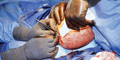 المنشآت الطبية تجري 10 عمليات قسطرة قلبية لحجاج من عدة جنسيات 