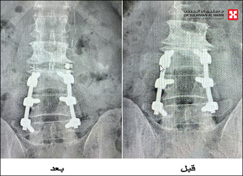 بجراحة نوعية متقدمة 