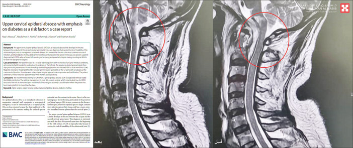 إنجاز جديد نشرته مجلة «PUPMED» الطبية العالمية 